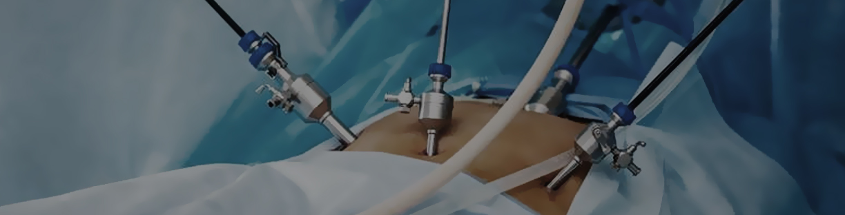 Laparoscopic Surgeries