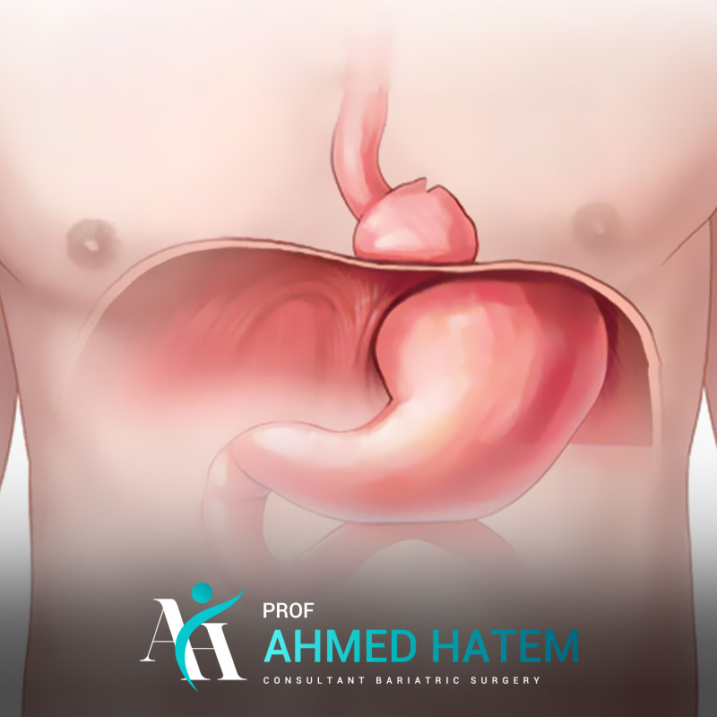 جراحات بالمنظار
